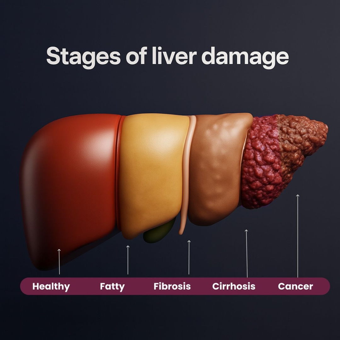 Liver Detox - 20 in 1